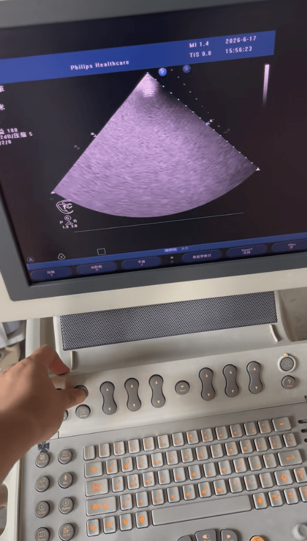 Get Premium Performance with a Used Philips HD11XE Ultrasound System