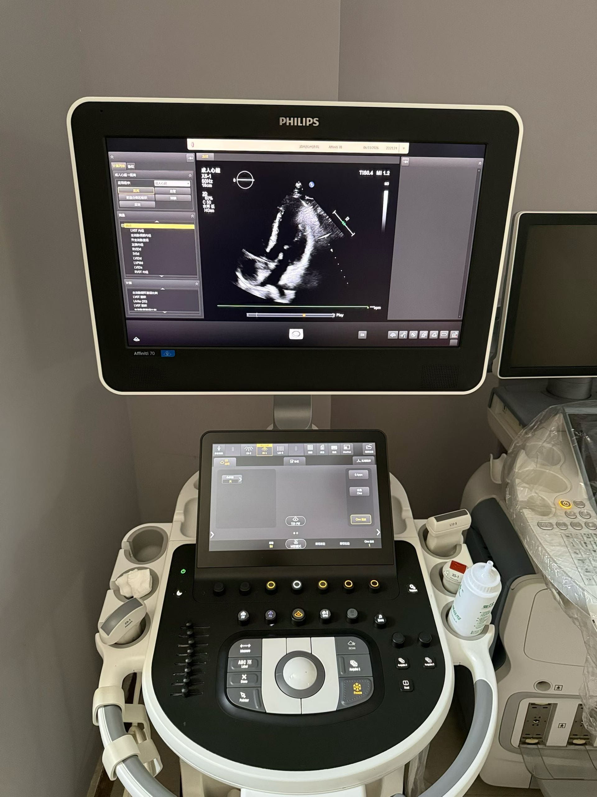 Premium Refurbished Philips Affiniti 70 Used Ultrasound Machine – Superior Shared-Service Imaging