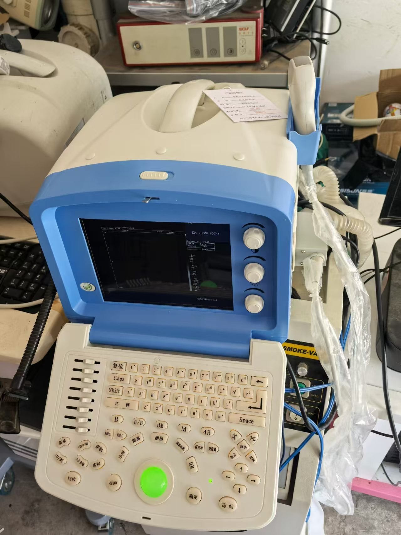 便携b超_2 Autonola ATNL/51353A Used Portable Ultrasound Scanner: Reliable and Cost-Effective Diagnostic Imaging