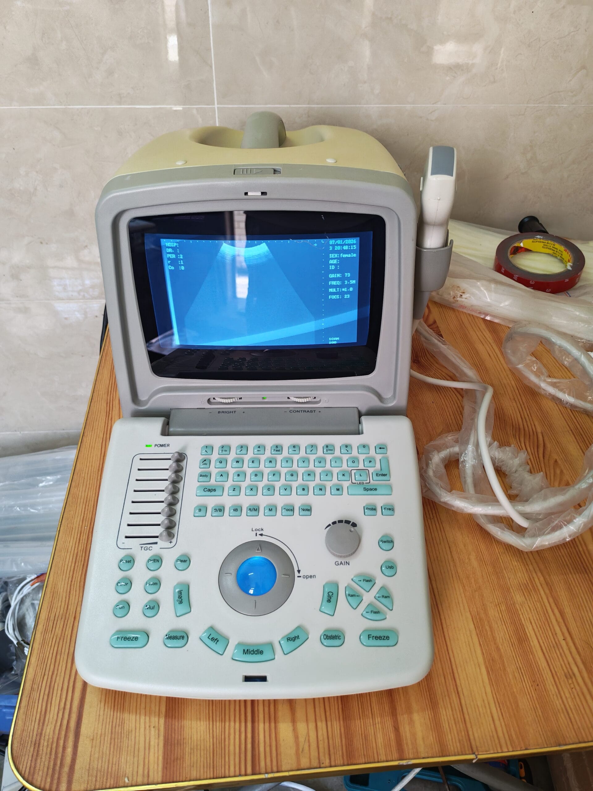 Buy a High-Quality Tianyi TY-6858A-1 Used Portable Ultrasound Machine