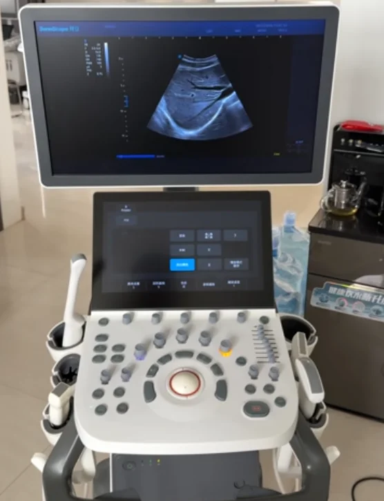 开立p10pro Enhance Clinical Precision with the SonoScape P10 Pro Used Ultrasound Machine